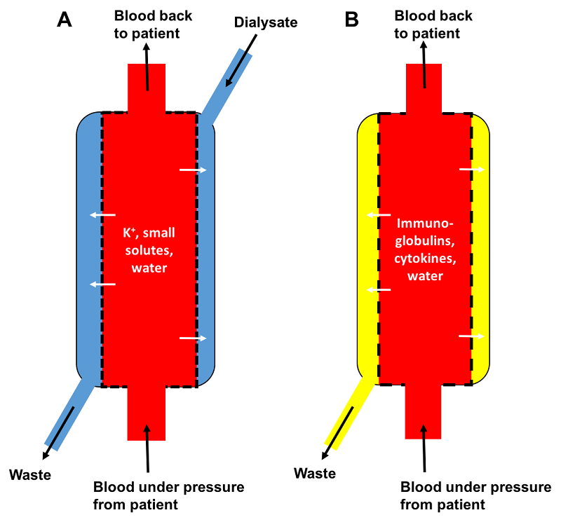 dialysis-and-therapeutic-plasma-exchange